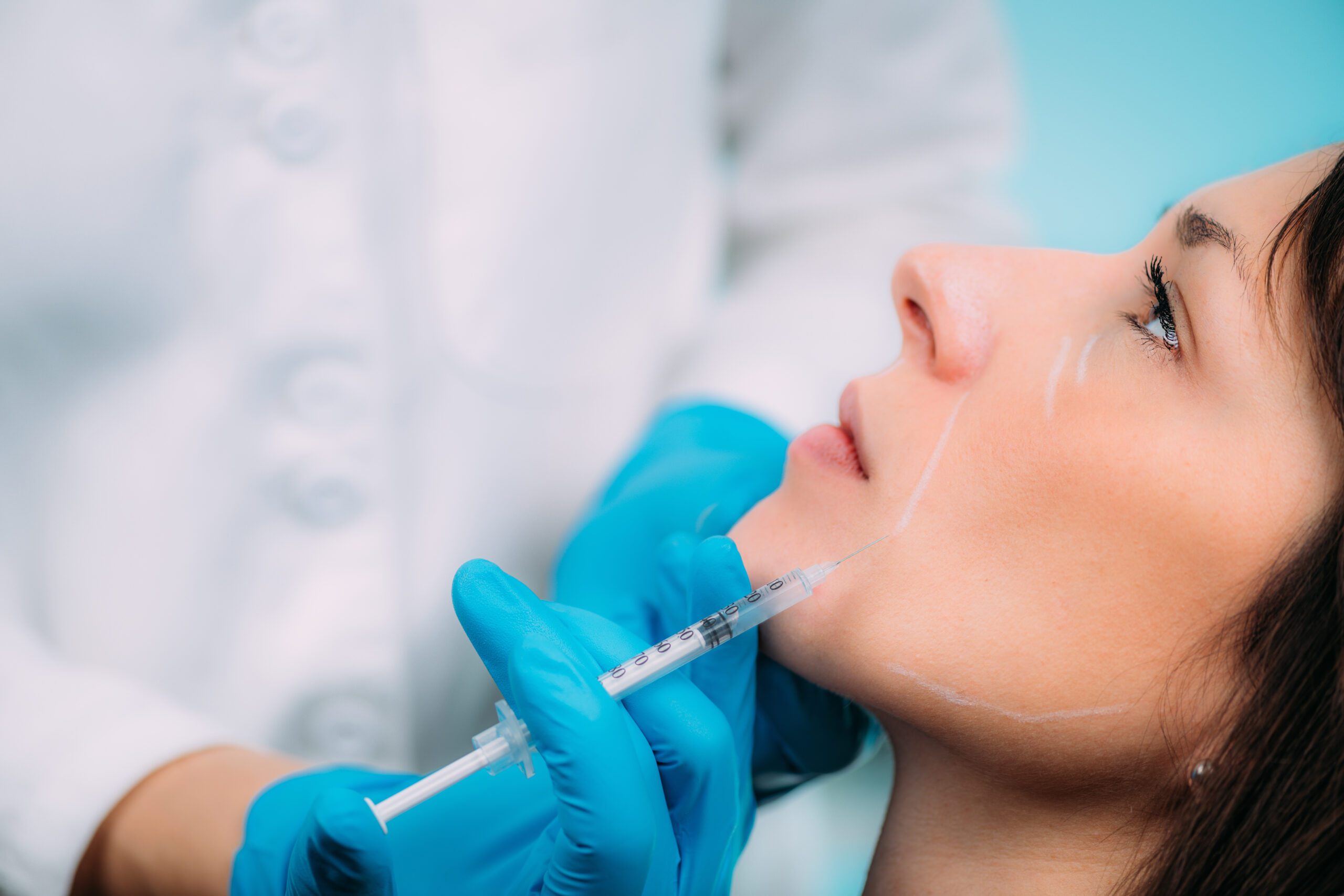 A person with blue gloves is getting their face filled