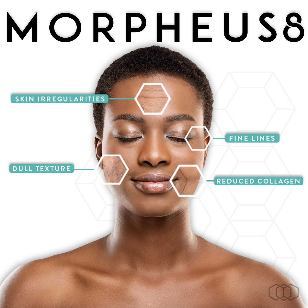 morpheus8-infographic-instagram-post-black-hair-preview-1 A person with their eyes closed and the words morpheus 8 written on them.